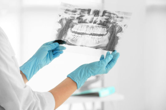 Female dentist holding a dental X-Ray