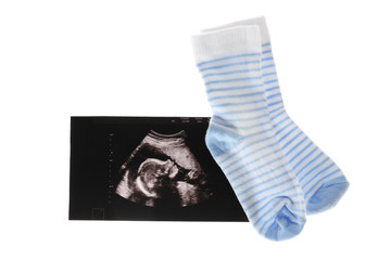 Ultrasound picture of baby and children socks on white background