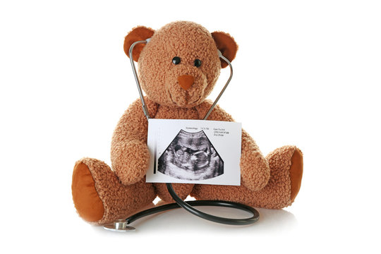 Teddy bear with ultrasound scan of baby and stethoscope on white background