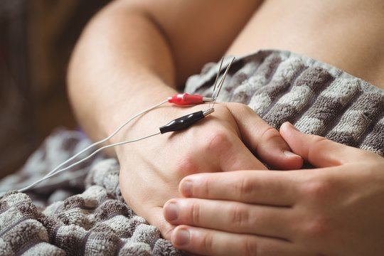 Patient getting electro dry needling on hand