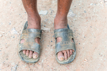 Legs of a labor with muddy