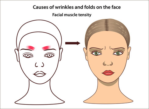 Тейпы на межбровку схема