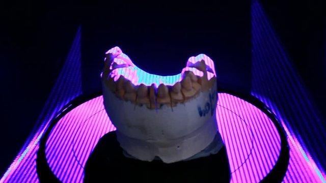 Dental Reconstruction of Lower Jaw with 3D Dental Scanner
