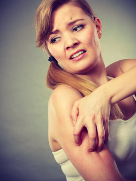 woman scratching her itchy arm with allergy rash