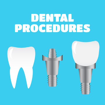 Stomatology and dental procedures vector illustration