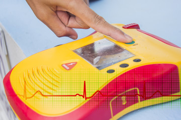 Automated External Defibrillator show finger push button open - obrazy, fototapety, plakaty