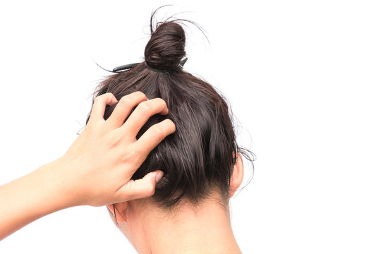 Closeup Woman Hand Itchy Scalp, Hair Care Concept