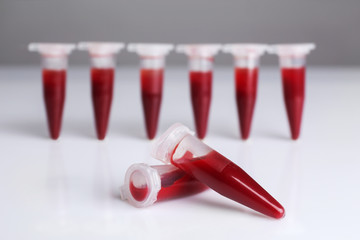 Test tubes filled with blood on gray blurred background, close up