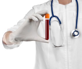 Doctor holding red blood in test tube on white background, close up