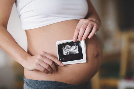 Pregnant woman expecting newborn
