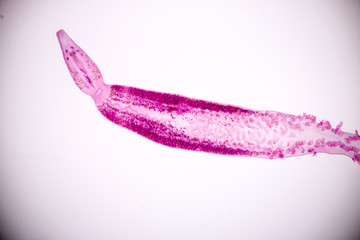 Flukes infestation (parasite) under microscope view.