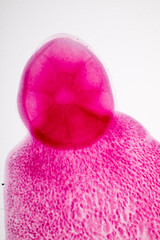 Flukes infestation (parasite) under microscope view.