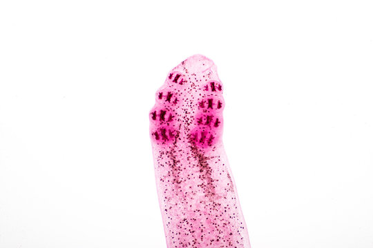 Flukes infestation (parasite) under microscope view.