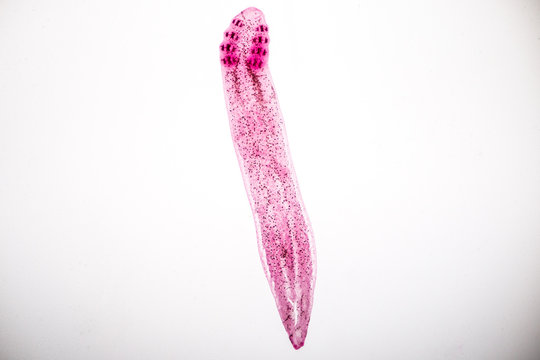 Flukes infestation (parasite) under microscope view.