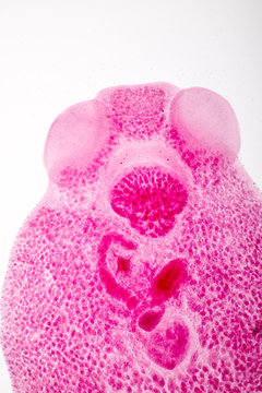 Flukes infestation (parasite) under microscope view.