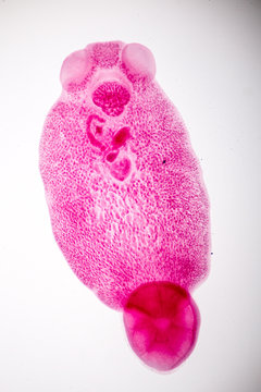 Flukes infestation (parasite) under microscope view.