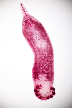 Flukes infestation (parasite) under microscope view.
