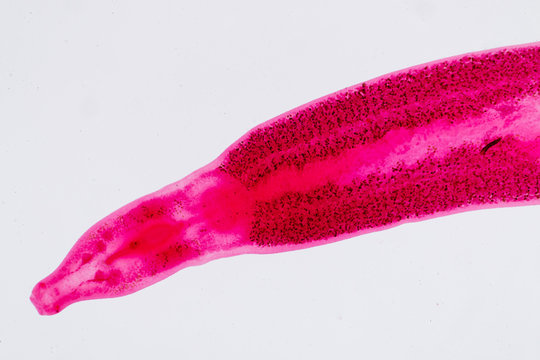 Flukes infestation (parasite) under microscope view.