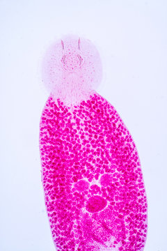 Flukes infestation (parasite) under microscope view.
