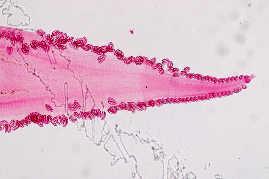 Flukes infestation (parasite) under microscope view.