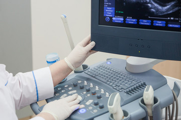 Ultrasound machine doctor"s hand usg inverstigation