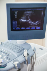 Ultrasound machine doctor"s hand usg inverstigation