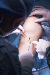 Obraz na płótnie Canvas Surgical operation knee surgery