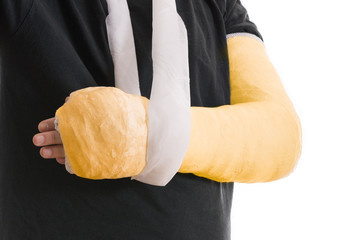 Broken arm in yellow plaster cast and sling