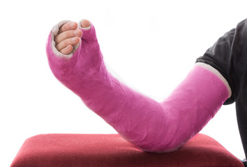 Pink long arm plaster / fiberglass cast resting on ottoman