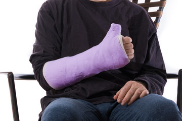 Young man making a thumbs up sign with his casted arm