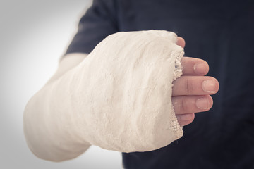 Close up of a long arm cast