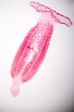 Pricea multae,Monogenea (parasite) under microscope view.