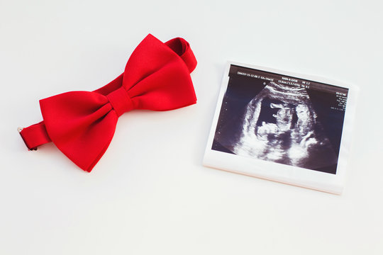 Ultrasound and red tie