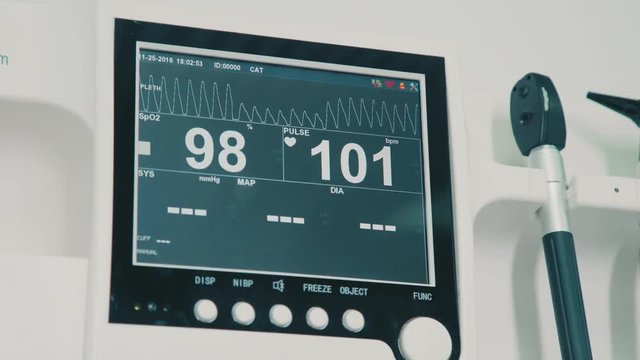 Monitor vital signs in a veterinary hospital: pulse and animal pressure. Monitor the pulse oximeter. Oygen saturation monitor