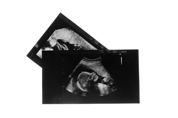 Ultrasound pictures of baby on white background