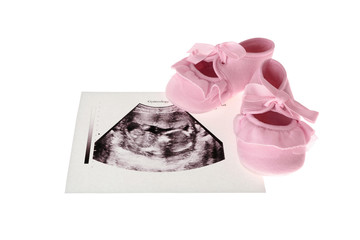 Ultrasound picture of baby and children shoes on white background