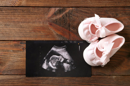 Ultrasound picture of baby and children shoes on wooden background