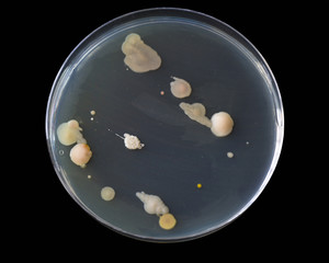 Bacteria on an agar plate