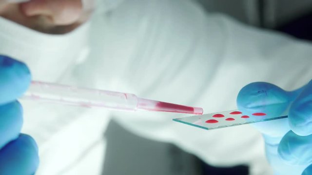 blood analysis in a laboratory, chemicals at work