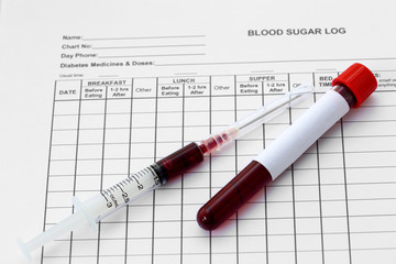 Syringe and plastic test tube with blood in laboratory