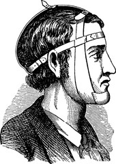 Vintage image bandaged head