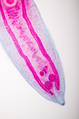 Parasite under the microscope.