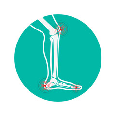 Human leg pain zones. Design elements for infographic. Vector illustration.