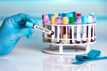 doctor holding tube with text Blood test / blood sample in tube labeled with text Blood test 