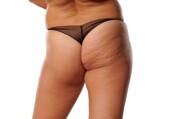 Obraz premium fat ass woman with cellulite