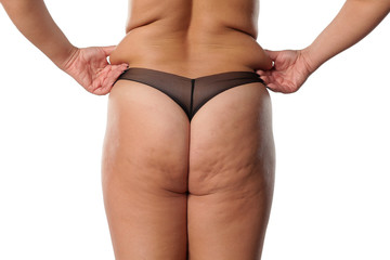 female butt with cellulite and fat on the waist