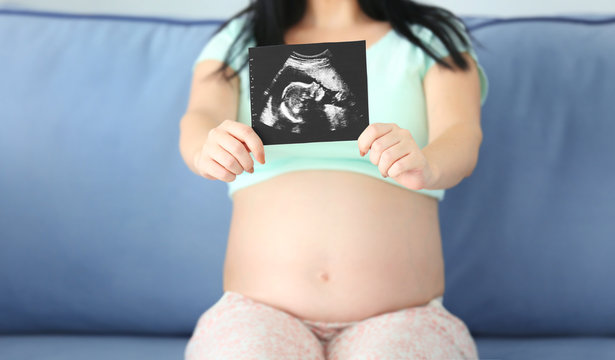 Pregnant woman showing ultrasound photo and sitting on sofa in the room