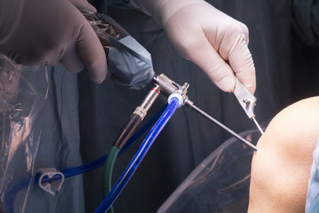 Surgical operation knee surgery
