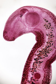 Echinostoma revolutum (parasite) under the microscope