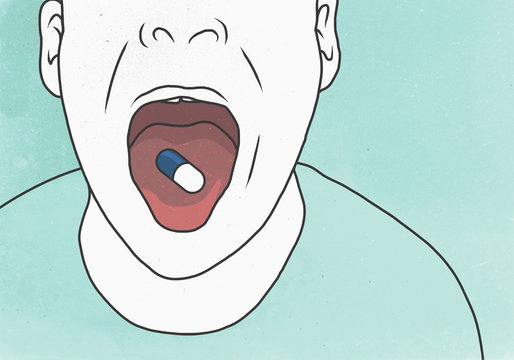 Illustration of man with capsule on tongue in mouth depicting illness